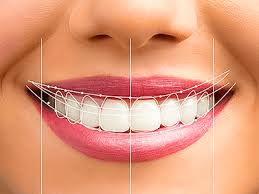 Smile Design / Smile Makeover
